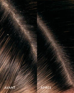 Huile Remède Cuir Chevelu Aceite De Moska -Cosmétiques De Mode AvantapresCeremonia AceitedeMoska